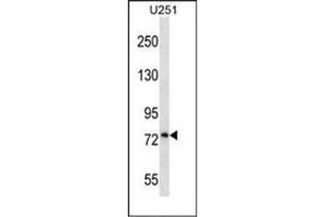 Western blot analysis of PLOD1 / PLOD Antibody (N-term) in U251 cell line lysates (35ug/lane). (PLOD1 Antikörper  (N-Term))
