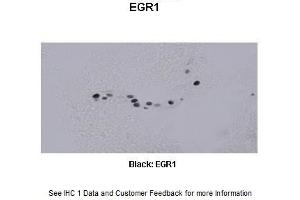 Sample Type : Frog brain Primary Antibody Dilution : 1:500 Secondary Antibody : Biotinylated goat anti-rabbit Secondary Antibody Dilution : 1:200 Color/Signal Descriptions : Black: EGR1 Gene Name : Egr1 a Submitted by : Eva Fischer, Colorado State University (EGR1 Antikörper  (C-Term))