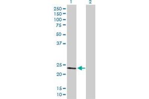 Western Blot analysis of SOD2 expression in transfected 293T cell line by SOD2 MaxPab polyclonal antibody. (SOD2 Antikörper  (AA 1-222))
