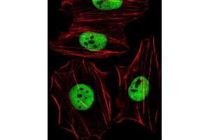 Fluorescent image of Hela cells stained with (Mouse) Smarcc1 Antibody (C-term) (ABIN6242636 and ABIN6577666). (SMARCC1 Antikörper  (C-Term))