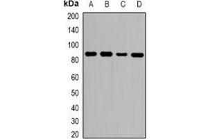 Western blot analysis of ZNF839 expression in HeLa (A), MCF7 (B), RAW264. (ZNF839 Antikörper)