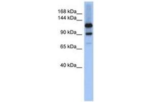 Image no. 1 for anti-Homeodomain Interacting Protein Kinase 1 (HIPK1) (AA 1043-1092) antibody (ABIN6743903) (HIPK1 Antikörper  (AA 1043-1092))