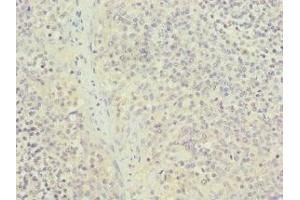 Immunohistochemistry of paraffin-embedded human tonsil tissue using ABIN7161949 at dilution of 1:100 (NUTF2 Antikörper  (AA 1-127))