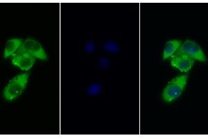 Detection of GCSFR in Human MCF7 cell using Polyclonal Antibody to Colony Stimulating Factor Receptor, Granulocyte (GCSFR) (CSF3R Antikörper  (AA 26-138))