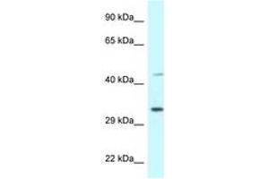 Image no. 1 for anti-Bone Marrow Stromal Cell Antigen 1 (BST1) (AA 108-157) antibody (ABIN6747338)
