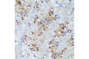 Immunohistochemistry of paraffin-embedded Mouse brain using GRSF1 Rabbit pAb (ABIN7267319) at dilution of 1:100 (40x lens). (GRSF1 Antikörper)