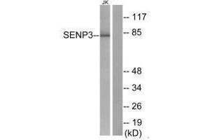 Western blot analysis of extracts from Jurkat cells, using SENP3 antibody. (SENP3 Antikörper)
