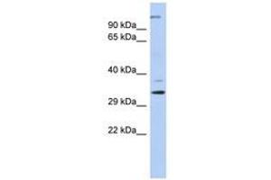 Image no. 1 for anti-Actin Related Protein 2/3 Complex, Subunit 2, 34kDa (ARPC2) (N-Term) antibody (ABIN6741467)