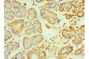 Immunohistochemistry of paraffin-embedded human pancreatic tissue using ABIN7153890 at dilution of 1:100 (GCK Antikörper  (AA 1-300))