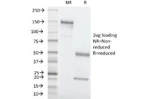 SDS-PAGE Analysis Purified CEA Mouse Monoclonal Antibody (C66/1260). (CEACAM5 Antikörper)