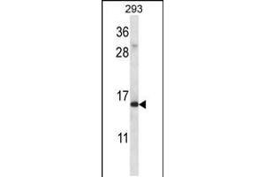 Western blot analysis in 293 cell line lysates (35ug/lane). (RPS19 Antikörper  (C-Term))