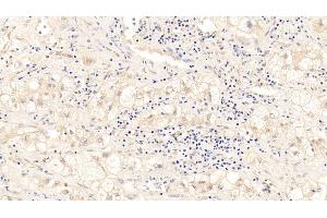 Immunohistochemistry (IHC) image for anti-TAR DNA Binding Protein (TARDBP) (AA 104-262) antibody (ABIN7434404)