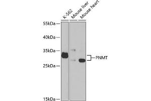 Western blot analysis of extracts of various cell lines, using PNMT antibody (ABIN6130644, ABIN6145848, ABIN6145850 and ABIN6221200) at 1:1000 dilution. (PNMT Antikörper  (AA 1-282))