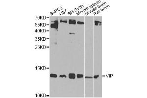 Western blot analysis of extracts of various cell lines, using VIP Antibody (ABIN5970913) at 1/1000 dilution. (Vip Antikörper)