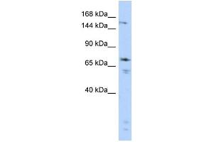 WB Suggested Anti-GRIN2B Antibody Titration:  0. (GRIN2B Antikörper  (Middle Region))