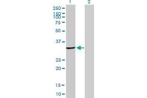 Western Blot analysis of DCK expression in transfected 293T cell line by DCK MaxPab polyclonal antibody. (DCK Antikörper  (AA 1-260))