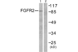 Western blot analysis of extracts from A549 cells, using FGFR2 antibody. (FGFR2 Antikörper  (Internal Region))