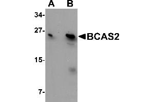 Western Blotting (WB) image for anti-Breast Carcinoma Amplified Sequence 2 (BCAS2) (C-Term) antibody (ABIN1030285) (BCAS2 Antikörper  (C-Term))