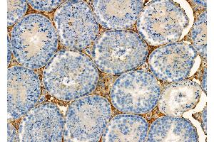 ABIN6257199 and ABIN6275956 at 1/100 staining Mouse testis tissue by IHC-P. (G Protein-Coupled Receptor 132 Antikörper  (C-Term))