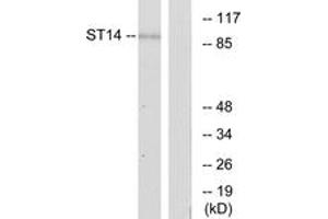 Western blot analysis of extracts from A549 cells, using ST14 Antibody.