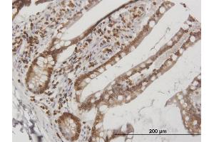 Immunoperoxidase of purified MaxPab antibody to LBR on formalin-fixed paraffin-embedded human small Intestine.