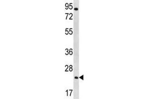 AQP5 antibody western blot analysis in NCI-H292 lysate (Aquaporin 5 Antikörper  (AA 227-256))