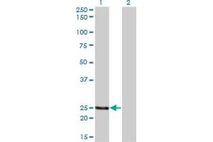 Western Blot analysis of PCTP expression in transfected 293T cell line by PCTP monoclonal antibody (M01A), clone 1F9. (PCTP Antikörper  (AA 1-214))