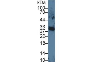 Detection of VEGF165 in Human Lung lysate using Monoclonal Antibody to Vascular Endothelial Growth Factor 165 (VEGF165) (VEGF 165 (AA 28-191) Antikörper)