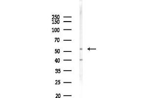 Western blot analysis of lysates from 293 cells(LPS 4h treatment), using PRPF19 Antibody at 1/1000 dilution.