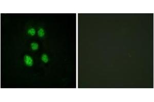 Immunofluorescence analysis of HeLa cells, using VAV1 (Ab-160) Antibody. (VAV1 Antikörper  (AA 131-180))