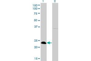 Western Blot analysis of NFYB expression in transfected 293T cell line by NFYB monoclonal antibody (M01), clone 6H6. (NFYB Antikörper  (AA 1-207))