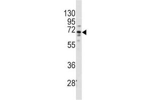 Western Blotting (WB) image for anti-Frizzled Family Receptor 1 (Fzd1) antibody (ABIN3001613) (FZD1 Antikörper)