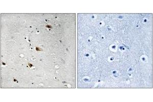 Immunohistochemistry analysis of paraffin-embedded human brain, using E2A (Phospho-Thr355) Antibody. (TCF3 Antikörper  (pThr355))