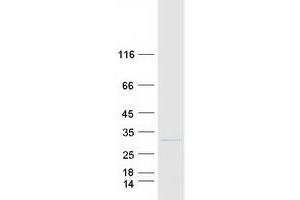 Validation with Western Blot (RPL13 Protein (Transcript Variant 2) (Myc-DYKDDDDK Tag))