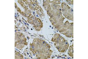 Immunohistochemistry of paraffin-embedded human stomach using CREBBP antibody (ABIN5974440) at dilution of 1/100 (40x lens). (CBP Antikörper)