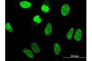 Immunofluorescence of monoclonal antibody to TAF11 on HeLa cell. (TAF11 Antikörper  (AA 158-210))