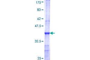 LGI3 Protein (AA 449-548) (GST tag)