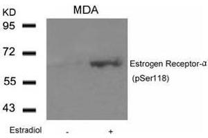 Image no. 3 for anti-Estrogen Receptor 1 (ESR1) (pSer118) antibody (ABIN196742) (Estrogen Receptor alpha Antikörper  (pSer118))