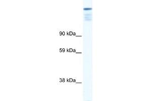 Human Muscle; WB Suggested Anti-ZFP106 Antibody Titration: 0. (ZFP106 Antikörper  (N-Term))