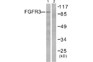 Western blot analysis of extracts from LOVO cells, using FGFR3 antibody. (FGFR3 Antikörper)