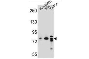 ARHGAP22 Antibody (C-term) western blot analysis in MDA-MB231,WiDr,ZR-75-1 cell line lysates (35µg/lane). (ARHGAP22 Antikörper  (C-Term))
