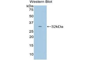 Western blot analysis of the recombinant protein. (CYP26A1 Antikörper  (AA 250-495))