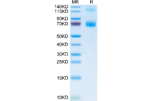 Fc epsilon RI/FCER1A Protein (AA 24-204) (Fc Tag)
