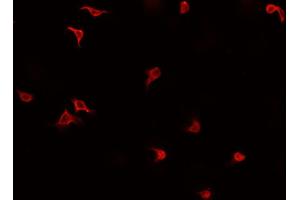 ABIN6269412 staining HeLa cells by IF/ICC. (SMAD2 Antikörper  (Internal Region))