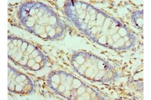 Immunohistochemistry of paraffin-embedded human colon tissue using ABIN7146923 at dilution of 1:100 (CARD8 Antikörper  (AA 1-200))
