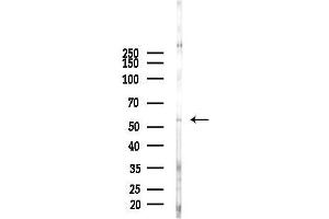 anti-Fascin 2 (FSCN2) antibody