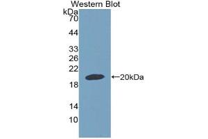 Western blot analysis of the recombinant protein. (GDF9 Antikörper  (AA 306-440))