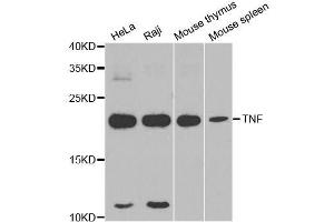 Western blot analysis of extracts of various cell lines, using TNF-α antibody. (TNF alpha Antikörper)