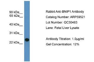 WB Suggested Anti-BNIP1  Antibody Titration: 0. (BNIP1 Antikörper  (C-Term))