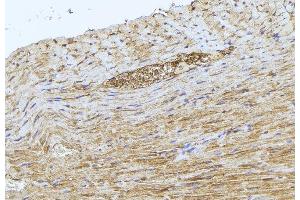 ABIN6277512 at 1/100 staining Mouse muscle tissue by IHC-P. (GCLM Antikörper  (N-Term))